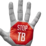 Lancet Study on TB