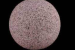 Radon