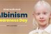 13 June: International Albinism Awareness Day observed