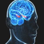 Tourette Syndrome