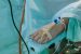 Medical Aid for Heart Patients in India