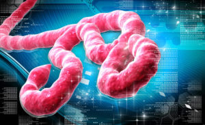 Ebola