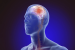 World Stroke Day