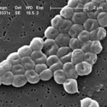 Bacterial Infections Second-Leading Cause of Death in 2019