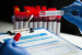 CCMB: Only centre pooling COVID-19 samples, To Culture virus in human lung cell