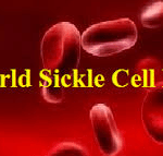 World Sickle Cell Day observed on June 19