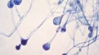 Mucormycosis