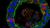 Organoids