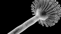 Aspergillosis