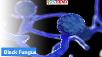 Mucormycosis-Black Fungus Infection in COVID Patients