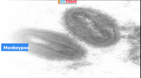 Task Force to monitor Monkeypox situation in India