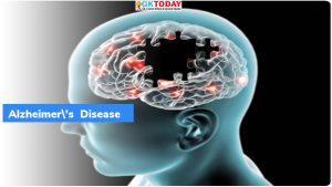 21 सितंबर: विश्व अल्जाइमर दिवस (World Alzheimer’s Day)