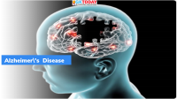 September 21: World Alzheimer’s Day