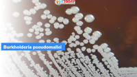 Burkholderia pseudomallei