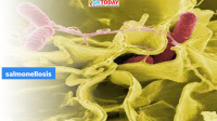 Salmonellosis