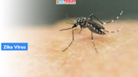 Zika Virus