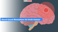IISc- Biomarkers to predict disease progression in brain tumour