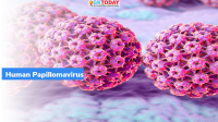 Human Papillomavirus