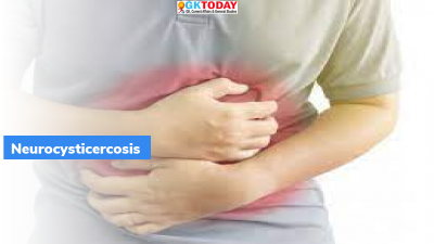 Neurocysticercosis
