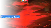 Photodynamic therapy