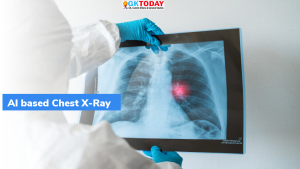 अब चेस्ट X-Ray से लगाया जा सकेगा कोविड का पता, IIT जोधपुर ने विकसित की तकनीक