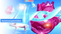 First Pig heart transplant in Human