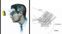 Intracortical Visual Prosthesis
