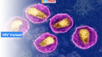The Netherlands New HIV variant