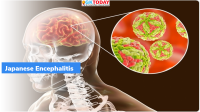 NIAB: Detection Method of Japanese Encephalitis Virus