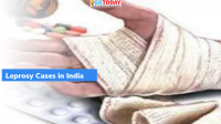 New Leprosy Cases during 2020-21 in India