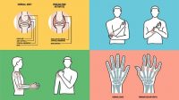 Clinical Trial in Ayurveda for Rheumatoid Arthritis