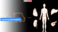 Xenotransplantation