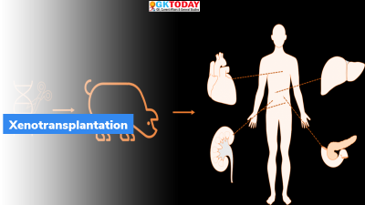 Xenotransplantation