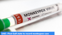 UAE : First Gulf state to record monkeypox case