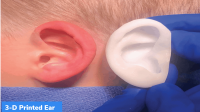 US: Reconstruction of 3D Ear