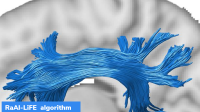 IISc: New algorithm to study brain connectivity