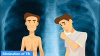 Health Ministry- Panchayat Ministry MoU to eliminate TB