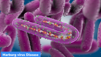 Marburg virus Disease