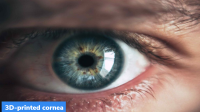 3D-printed cornea from Human Donor Corneal Tissue