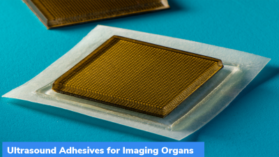 MIT: Ultrasound Adhesives for Imaging Organs