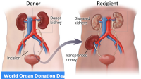 August 13: World Organ Donation Day
