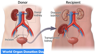 August 13: World Organ Donation Day