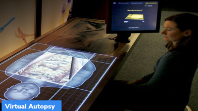 Virtual autopsy