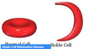 Mission to eliminate Sickle Cell Anaemia by 2047