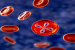 Babesiosis