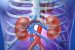 What is Acute Kidney Injury?