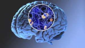 डोनानेमैब (Donanemab) क्या है?