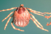 Crimean-Congo Hemorrhagic Fever (CCHF)