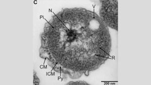 Poriferisphaera hetertotrophicis