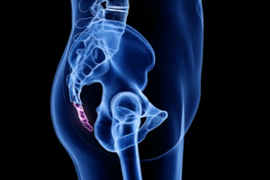 Why did Humans lose their Tails?